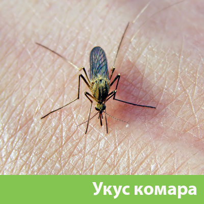 Укусы комаров в Воткинске