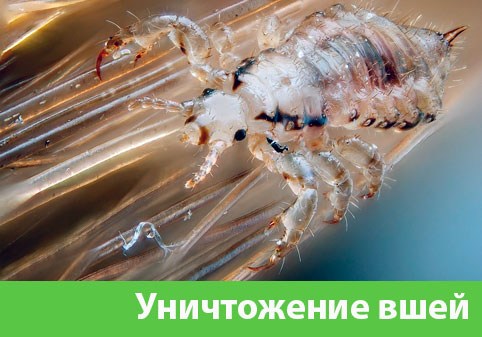 Уничтожение вшей в городе Воткинск